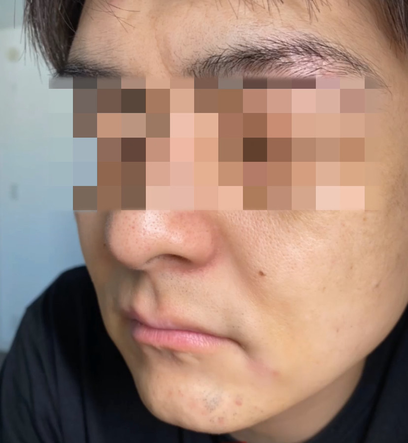 男性が毎日パックした結果